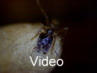 Pheidologeton mit prasitären Milben Video